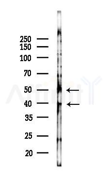 BCL7A Antibody - Western blot analysis of lysates from 293 cells(heat-shock,45min treatment), using BCL7A Antibody at 1/1000 dilution.