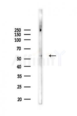 Cytochrome P450 26C1 Antibody - Western blot analysis of lysates from B16F10-LUC cells(UV,30min treatment), using Cytochrome P450 26C1 Antibody at 1/1000 dilution.