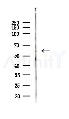 Cytochrome P450 4A11/22 Antibody - Western blot analysis of lysates from COLO205 cells(LPS,4h treatment), using Cytochrome P450 4A11/22 Antibody at 1/1000 dilution.