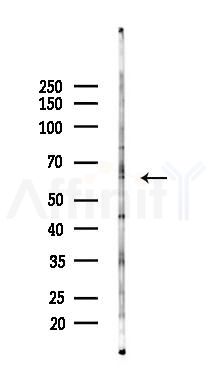 Cytochrome P450 4A11/22 Antibody - Western blot analysis of lysates from Mouse testis, using Cytochrome P450 4A11/22 Antibody at 1/1000 dilution.