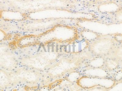 Cytochrome P450 4X1 Antibody - DF4751 at 1/100 staining human normal kidney tissue by IHC-P.