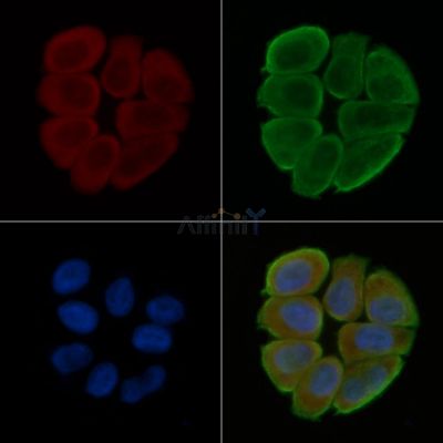 Cytochrome P450 2A6V2 Antibody - DF4754 staining Hela cells(30min of UV treatment) by IF/ICC.