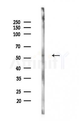 Cytochrome P450 2A7 Antibody - Western blot analysis of lysates from LoVo cells(heat-shock,45min treatment), using Cytochrome P450 2A7 Antibody at 1/1000 dilution.