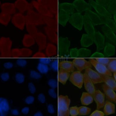 Cytochrome P450 2D6 Antibody - DF4758 staining Hela cells(30min of UV treatment) by IF/ICC.