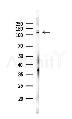 MRIP Antibody - Western blot analysis of lysates from A375 cells(heat-shock,45min treatment), using MRIP Antibody at 1/1000 dilution.