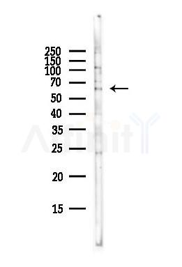 BAG3 Antibody - Western blot analysis of lysates from Hela cells(starvation,24h treatment), using BAG3 Antibody at 1/1000 dilution.
