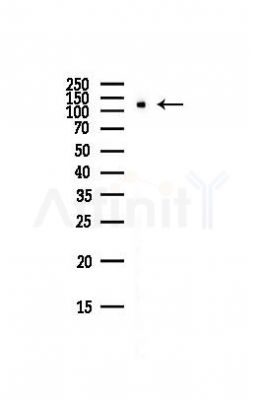EPHB1 Antibody - Western blot analysis of lysates from Hela cells(starvation,24h treatment), using EPHB1 Antibody at 1/1000 dilution.