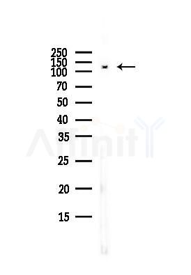 EPHB1 Antibody - Western blot analysis of lysates from HUVEC cells(starvation,24h treatment), using EPHB1 Antibody at 1/1000 dilution.