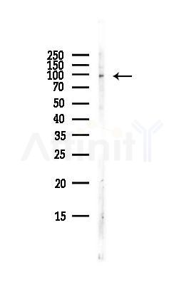 MASTL Antibody - Western blot analysis of lysates from Hela cells(starvation,24h treatment), using MASTL Antibody at 1/1000 dilution.