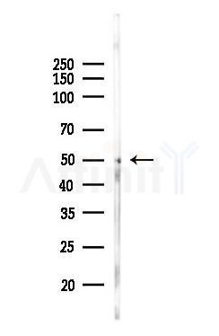 MKNK2 Antibody - Western blot analysis of lysates from A375 cells(heat-shock,45min treatment), using MKNK2 Antibody at 1/1000 dilution.