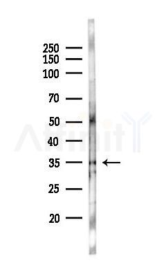 APOE Antibody - Western blot analysis of lysates from A375 cells(heat-shock,45min treatment), using APOE Antibody at 1/1000 dilution.