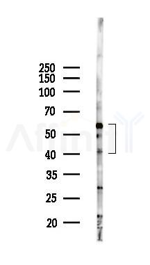 ERI1 Antibody - Western blot analysis of lysates from B16F10-LUC cells(starvation,24h treatment), using ERI1 Antibody at 1/1000 dilution.