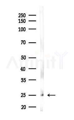 THY1 Antibody - Western blot analysis of lysates from Rat brain, using THY1 Antibody at 1/1000 dilution.