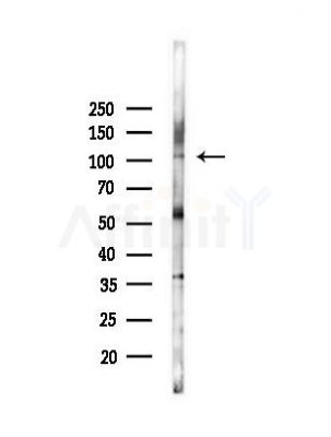 FCRL5 Antibody - Western blot analysis of lysates from B16F10-LUC cells(heat-shock,45min treatment), using FCRL5 Antibody at 1/1000 dilution.