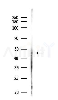 CSF2RA Antibody - Western blot analysis of lysates from COLO205 cells(heat-shock,45min treatment), using CSF2RA Antibody at 1/1000 dilution.