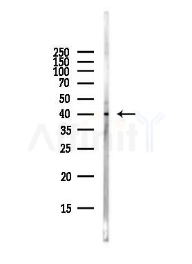 RRM2B Antibody - Western blot analysis of lysates from Hela cells(starvation,24h treatment), using RRM2B Antibody at 1/1000 dilution.