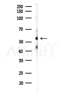 INA Antibody - Western blot analysis of lysates from Rat brain, using INA Antibody at 1/1000 dilution.