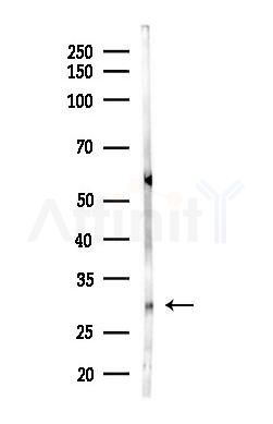 TOLLIP Antibody - Western blot analysis of lysates from Rat brain, using TOLLIP Antibody at 1/1000 dilution.