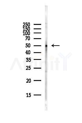 5HT2C Receptor Antibody - Western blot analysis of lysates from Hela cells(starvation,24h treatment), using 5HT2C Receptor Antibody at 1/1000 dilution.