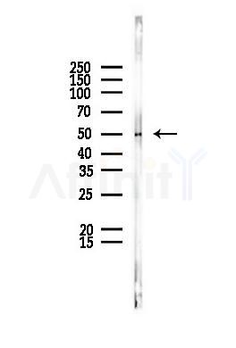 5HT2C Receptor Antibody - Western blot analysis of lysates from PC12 cells, using 5HT2C Receptor Antibody at 1/1000 dilution.