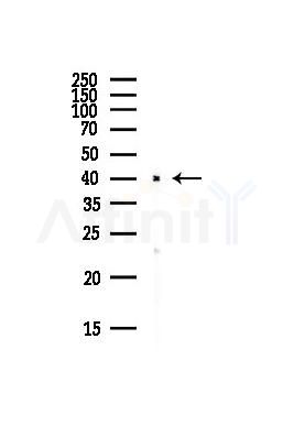 CXCR3 Antibody - Western blot analysis of lysates from Hela cells(starvation,24h treatment), using CXCR3 Antibody at 1/1000 dilution.