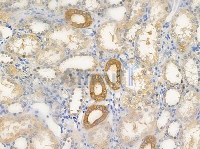 CCBP2 Antibody - DF4860 at 1/100 staining human normal kidney tissue by IHC-P.