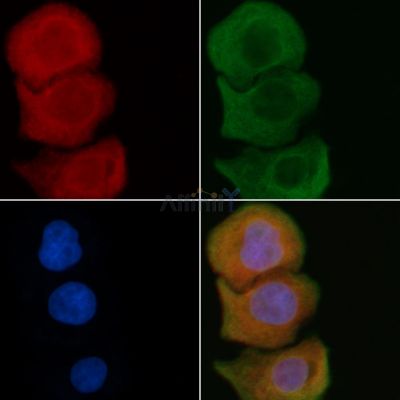 EDG2 Antibody - DF4868 staining Hela cells by IF/ICC.