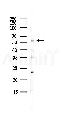 PE2R4 Antibody - Western blot analysis of lysates from EC304 cells(heat-shock,45min treatment), using PE2R4 Antibody at 1/1000 dilution.