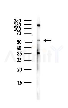 FZD2 Antibody - Western blot analysis of lysates from HepG2 cells(LPS,4h treatment), using FZD2 Antibody at 1/1000 dilution.