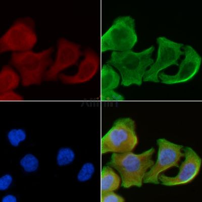 GPR171 Antibody - DF4900 staining Hela cells(30min of UV treatment) by IF/ICC.