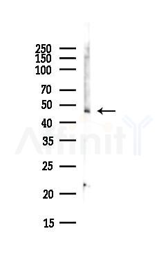 CHRM1 Antibody - Western blot analysis of lysates from EC304 cells(heat-shock,45min treatment), using CHRM1 Antibody at 1/1000 dilution.