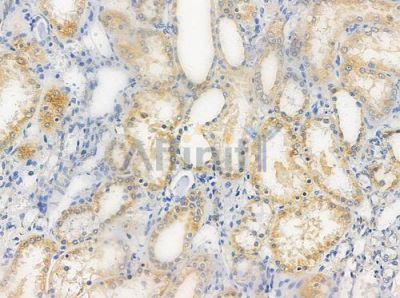 CLTR1 Antibody - DF4916 at 1/100 staining human normal kidney tissue by IHC-P.