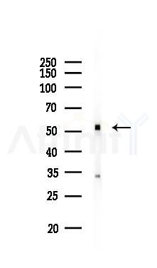 CNR1 Antibody - Western blot analysis of lysates from Mouse lung, using CNR1 Antibody at 1/1000 dilution.
