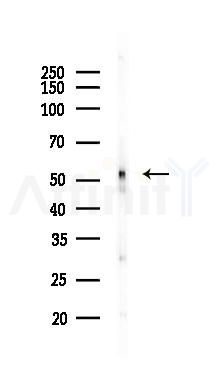 CNR1 Antibody - Western blot analysis of lysates from Rat liver, using CNR1 Antibody at 1/1000 dilution.