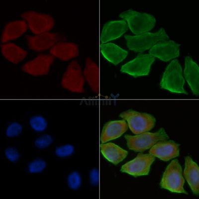 EDG4 Antibody - DF4920 staining Hela cells(30min of UV treatment) by IF/ICC.