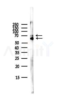 FZD8 Antibody - Western blot analysis of lysates from HepG2 cells(LPS,4h treatment), using FZD8 Antibody at 1/1000 dilution.