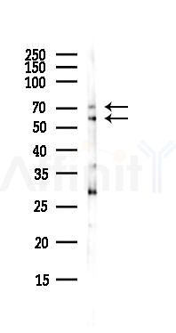 FZD8 Antibody - Western blot analysis of lysates from EC304 cells(heat-shock,45min treatment), using FZD8 Antibody at 1/1000 dilution.