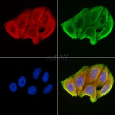 FZD9 Antibody - DF4932 staining Hela cells(30min of UV treatment) by IF/ICC.