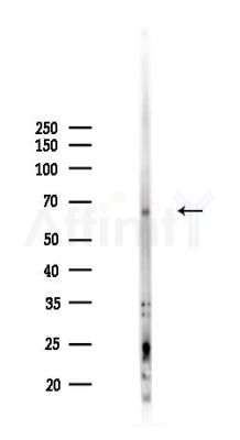 FZD9 Antibody - Western blot analysis of lysates from B16F10-LUC cells(starvation,24h treatment), using FZD9 Antibody at 1/1000 dilution.