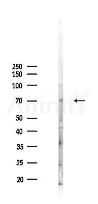 FZD9 Antibody - Western blot analysis of lysates from HepG2 cells(heat-shock,45min treatment), using FZD9 Antibody at 1/1000 dilution.