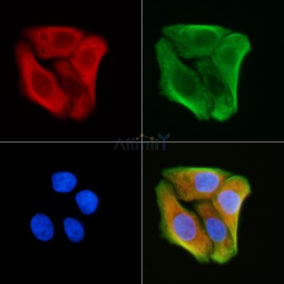 GPR137C Antibody - DF4933 staining Hela cells(30min of UV treatment) by IF/ICC.