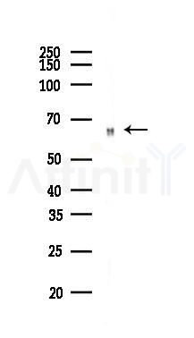 GPR107 Antibody - Western blot analysis of lysates from 293 cells(UV,30min treatment), using GPR107 Antibody at 1/1000 dilution.