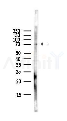 GPR32 Antibody - Western blot analysis of lysates from HepG2 cells(LPS,4h treatment), using GPR32 Antibody at 1/1000 dilution.