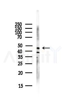 GPR83/GPR72 Antibody - Western blot analysis of lysates from HepG2 cells(LPS,4h treatment), using GPR83/GPR72 Antibody at 1/1000 dilution.