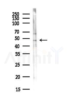 GPR83/GPR72 Antibody - Western blot analysis of lysates from EC304 cells(heat-shock,45min treatment), using GPR83/GPR72 Antibody at 1/1000 dilution.