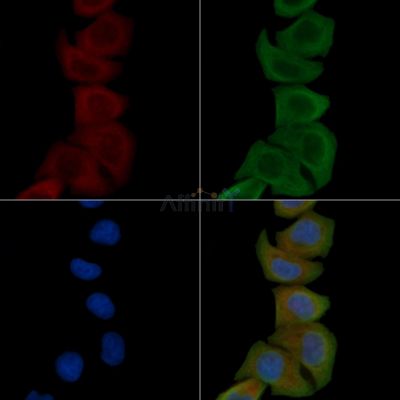 MSHR Antibody - DF4992 staining Hela cells by IF/ICC.