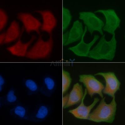MTLR Antibody - DF4993 staining Hela cells by IF/ICC.