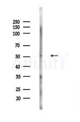 GPROPDR Antibody - Western blot analysis of lysates from LoVo cells(heat-shock,45min treatment), using GPROPDR Antibody at 1/1000 dilution.