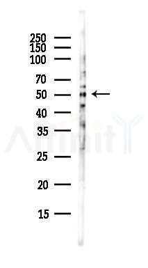 NK1R Antibody - Western blot analysis of lysates from EC304 cells(heat-shock,45min treatment), using NK1R Antibody at 1/1000 dilution.