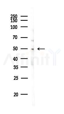 NK1R Antibody - Western blot analysis of lysates from PC12 cells, using NK1R Antibody at 1/1000 dilution.